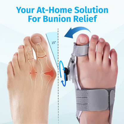 Vathera™ Bunion Fix